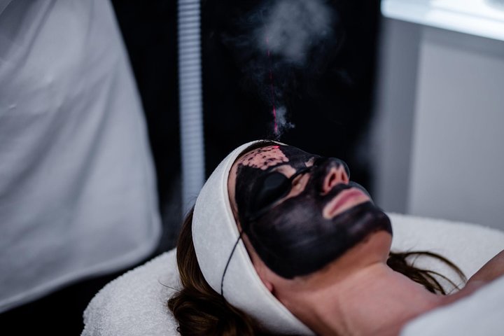 Spectral Peeling Laser Black doll in Bemerode, Hannover